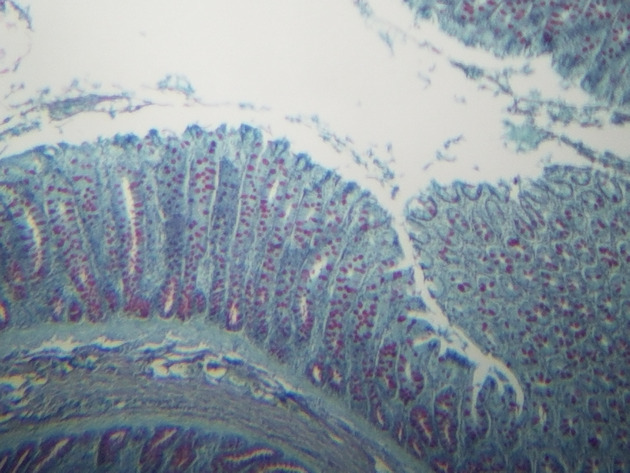 Simple Columnar Epithelium Slides - Simple Columnar Epithelium 03 40X
